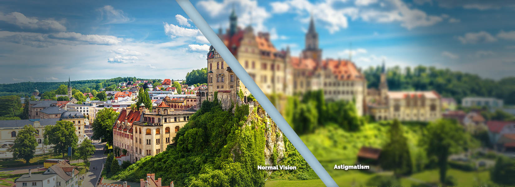 Astigmatism Treatment in Lakeville