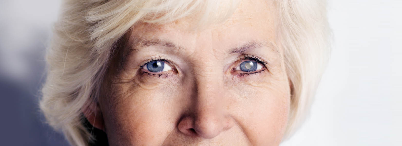 Cataract Surgery in Lakeville